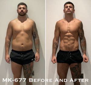 MK 677 (Ibutamoren) Review, Before And After Results .